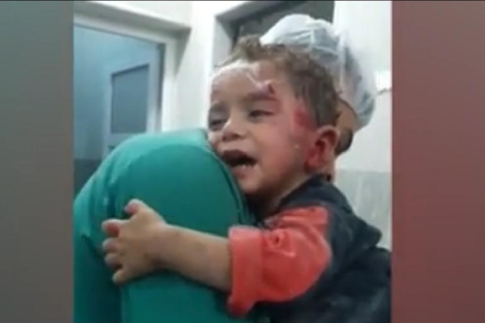 Čiko, zagrli me, molim te: Ceo svet plače posle snimka sirijskog dečaka oblivenog krvlju (VIDEO)