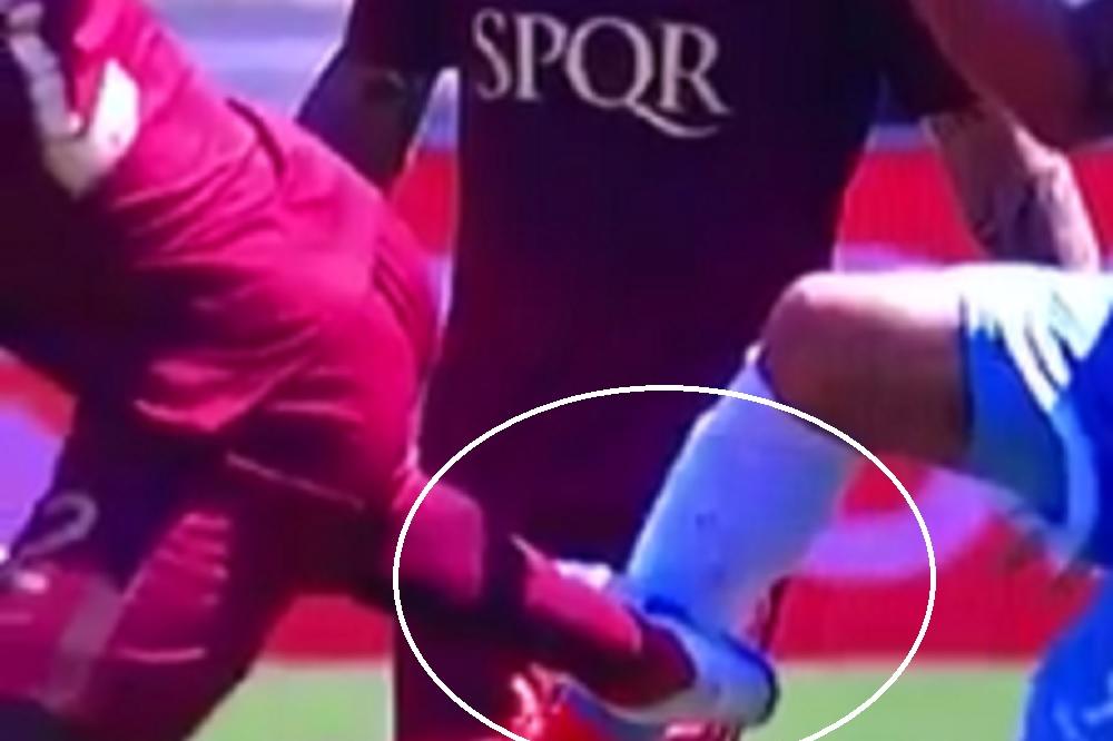 MONSTRUM! Divljak koji se predstavlja kao fudbaler Rome umalo prepolovio nogu bivšem igraču Zvezde! (VIDEO)