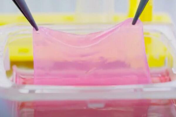 NEVEROVATNA INOVACIJA: Napravljena mašina koja razvija novu kožu za pacijente sa opekotinama! (VIDEO)