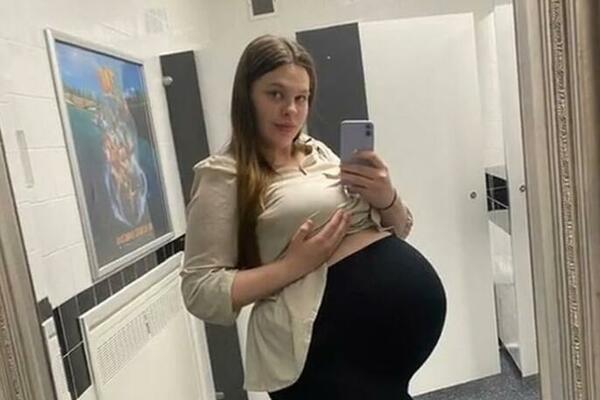FIT MAME BLAGO VAMA, ALI OVO JE REALNOST: Kako izgleda žensko telo 3 dana PRE i 3 nedelje POSLE porođaja (FOTO)