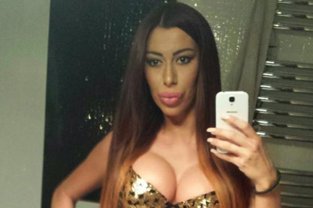 MIMI ORO IZVADILA SILIKONE: Da li vam se više sviđala ranije? (FOTO)