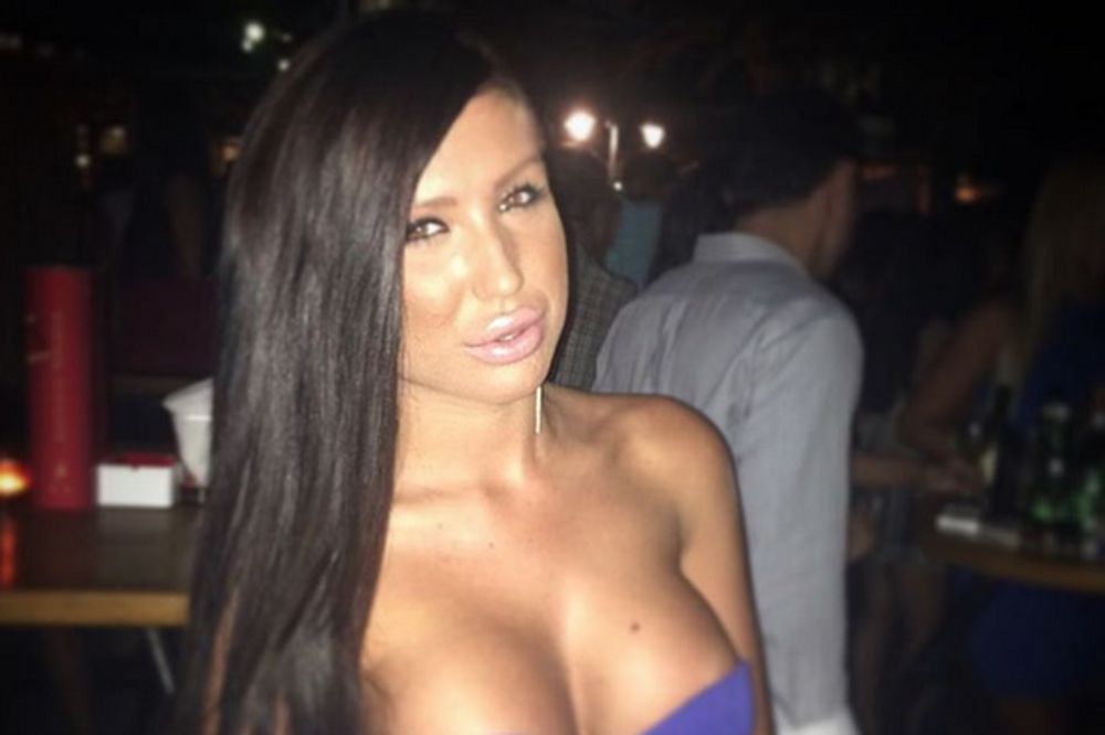 Tijana Ajfon završila u gipsu, ali prava vest su NJENE ŠTAKE (FOTO)