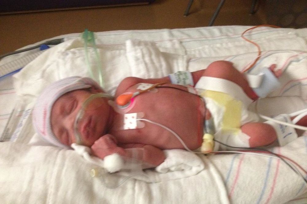 JEZIVO: Broj beba NAVUČENIH NA DROGU porastao ČETIRI PUTA!