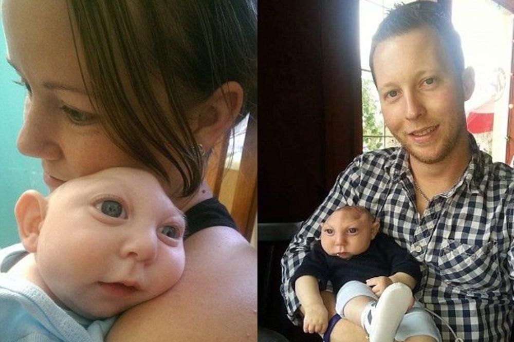 SRCE MALENO: Beba rođena bez lobanje proslavila PRVI ROĐENDAN! (FOTO) (VIDEO)