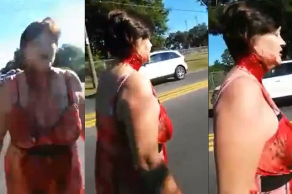 HODAM SAD KAO ZOMBI: Preklana žena šeta ulicom! (UZNEMIRUJUĆI VIDEO)