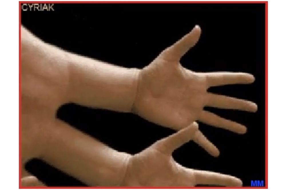 Testirajte svoj um: KOLIKO PRSTIJU VIDITE?