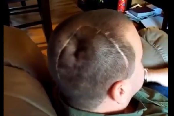 Ovaj čovek usisava i isisava sopstvenu lobanju! Ne verujete? (VIDEO)