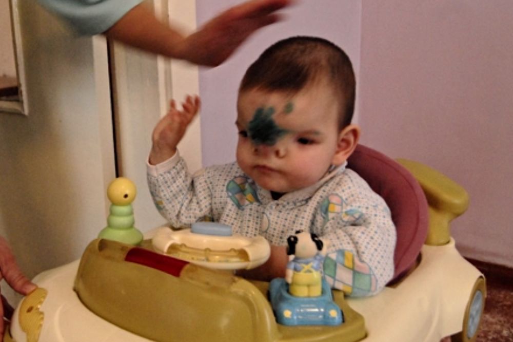 Stravične posledice radijacije! Ne gledajte ako imate slab želudac! (VIDEO)