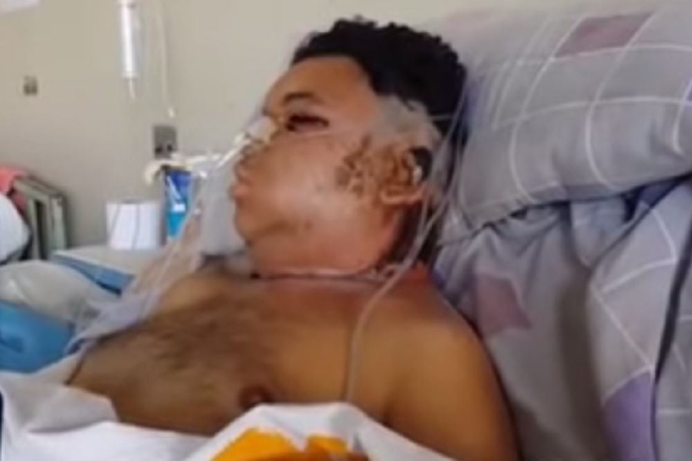 Ujeo ga je najopasniji pauk za svetu, sada se bori za život! (VIDEO)