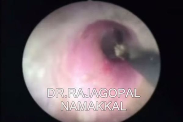 Mislila je da je luda zbog glasova u glavi, ali istina je bila mnogo gora! (VIDEO)