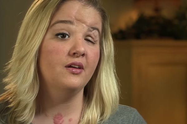 Kucala je poruke dok je vozila. Zato danas izgleda ovako! (FOTO)