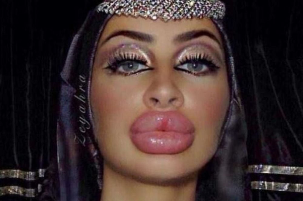 Ova žena ima najveće usne na svetu i izgleda totalno bizarno! (FOTO)