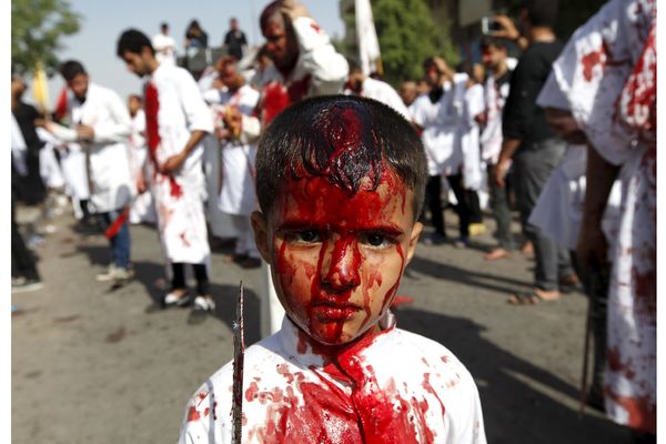 Stotine sakatile glave mačetama na islamskom Ašura obredu (UZNEMIRUJUĆI FOTO)