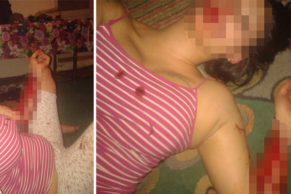 Presekla vene, objavila fotke na Fejsu, a onda krvava otišla u kafanu u Ćupriji!