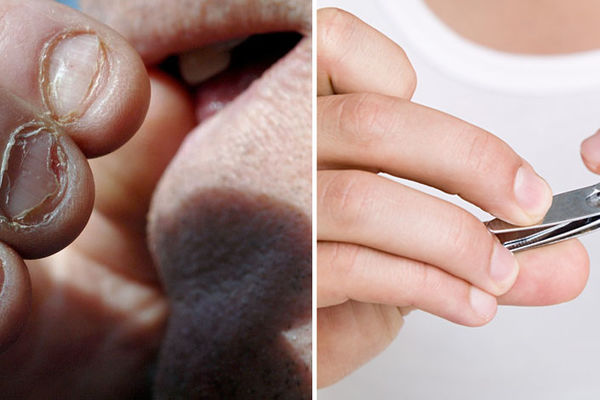 Grickate nokte? Evo zašto nikad to više nećete činiti! (GIF) (VIDEO)