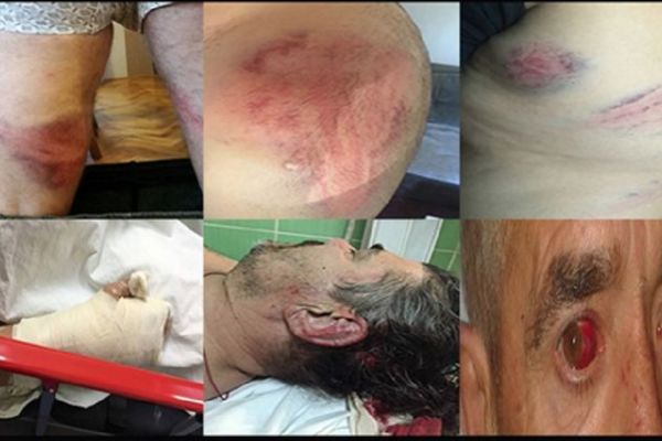 Brutalnost Milove policije: Tukli su narod nemilosrdno i to je izgledalo ovako! (FOTO)