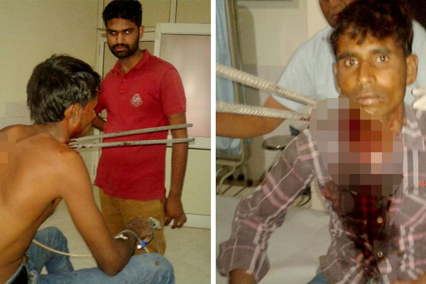 Nije verovao da je još uvek živ: Motociklisti se čelične šipke zarile u vrat (FOTO) (VIDEO)