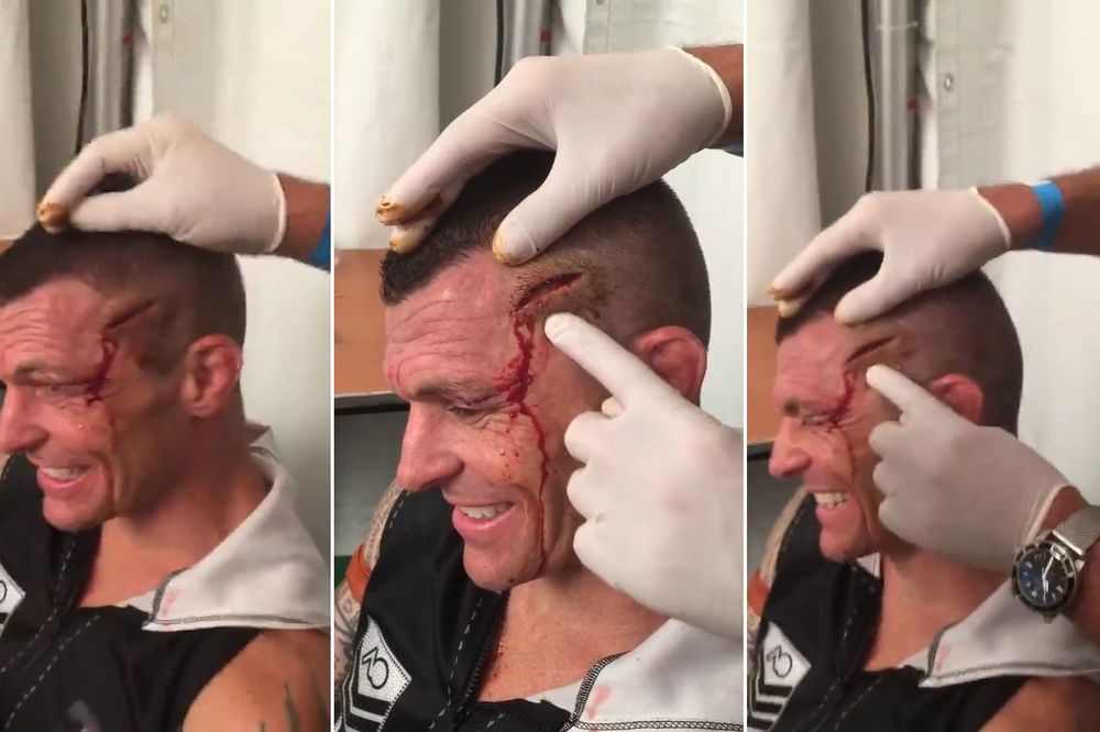 Ovo još niste videli: Rana koja govori! (VIDEO)