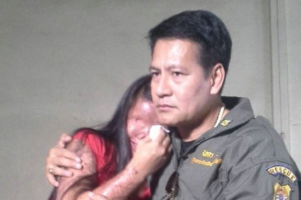 Izgubila je lice u tragičnoj nesreći, a njen muž pokazao je svetu šta je prava ljubav! (UZNEMIRUJUĆI FOTO)