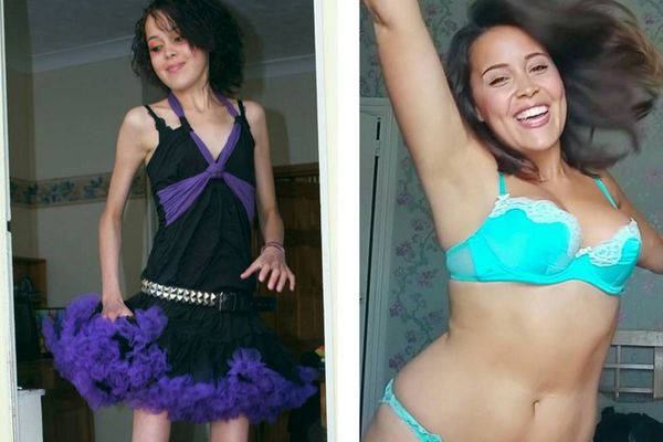 Bolje da ljulja, nego da žulja: Britanka izlečila anoreksiju i ne stidi se da to pokaže (FOTO)