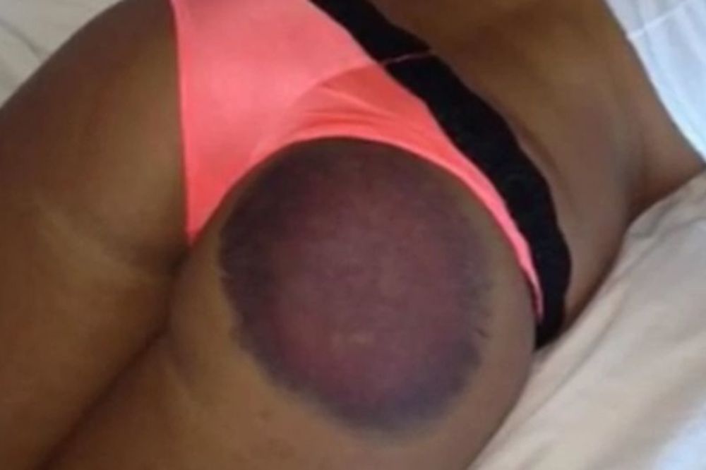 Guza Plejboj zečice je poslužila kao postolje za lopticu golferu i sada izgleda ovako! (VIDEO)