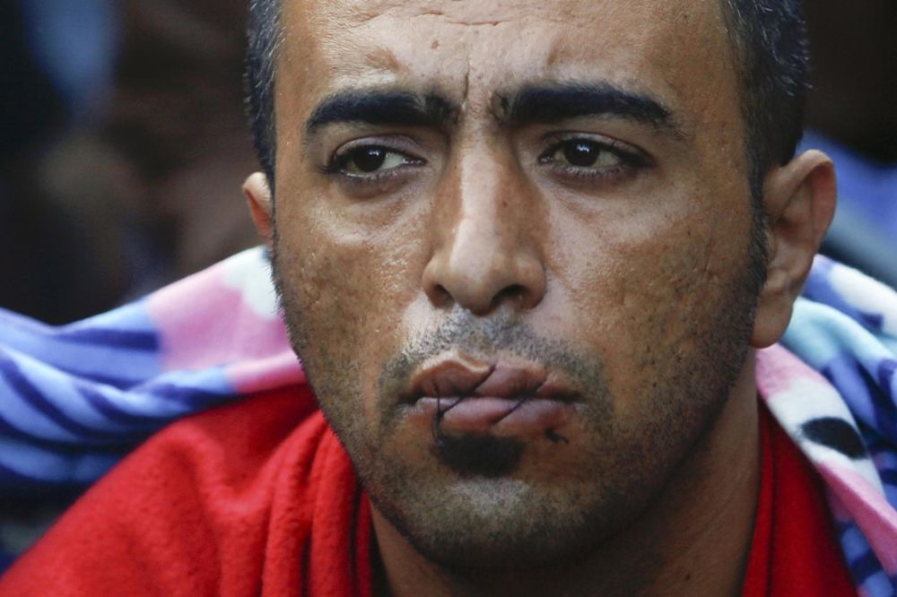 Zašivaju sami sebi usta: Brutalni štrajk migranata na makedonskoj granici! (FOTO)