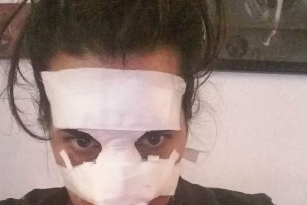 Ćerka naše poznate glumice brutalno pretučena u noćnom klubu! (FOTO)