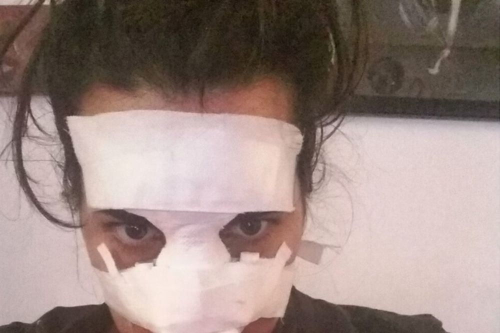 Ćerka naše poznate glumice brutalno pretučena u noćnom klubu! (FOTO)