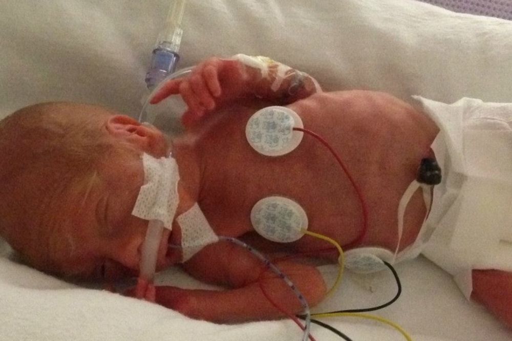 Ovom mališanu nisu davali nikakve šanse kad se rodio, ali je pokazao šta znači boriti se! (FOTO)