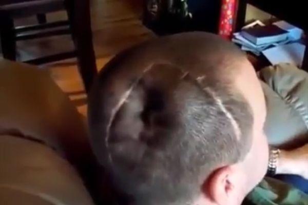 Da se naježiš: On ima glavu na naduvavanje! (VIDEO)