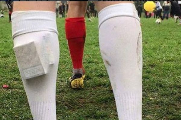 Fotka koja je osvojila društvene mreže: Ovako se igra niželigaški fudbal! (FOTO)