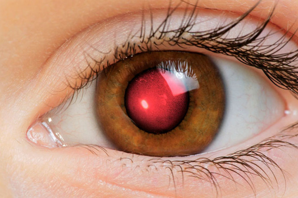 I vas nervira? Rešite se crvenih očiju s fotografija! (VIDEO)