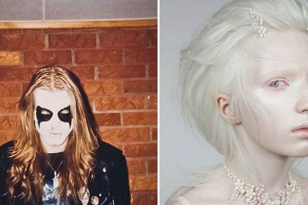 12 najjezivijih bolesti za koje niste znali da postoje (FOTO)