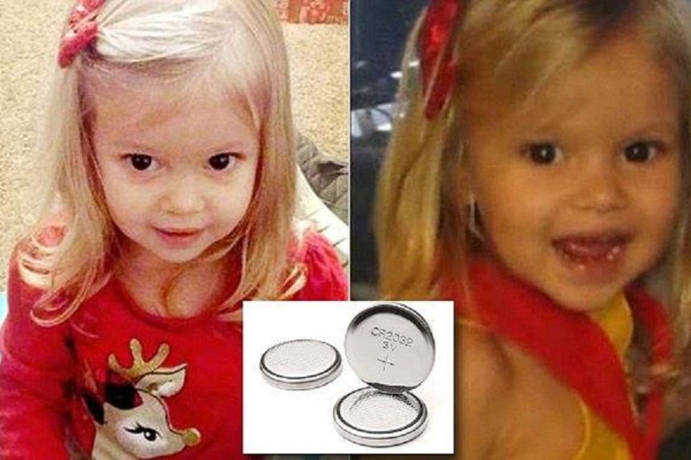 Devojčica (2) preminula nakon što je progutala dugme-bateriju! (FOTO) (VIDEO)