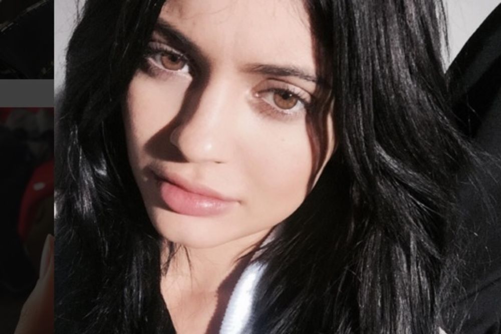 Pokušala da liči na Kajli Džener, a sada plaši ljude! (FOTO)