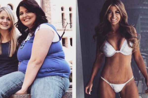 Ova bucka pretvorila se u pravu ribetinu: Evo kako sam smršala 70 kila! (FOTO)