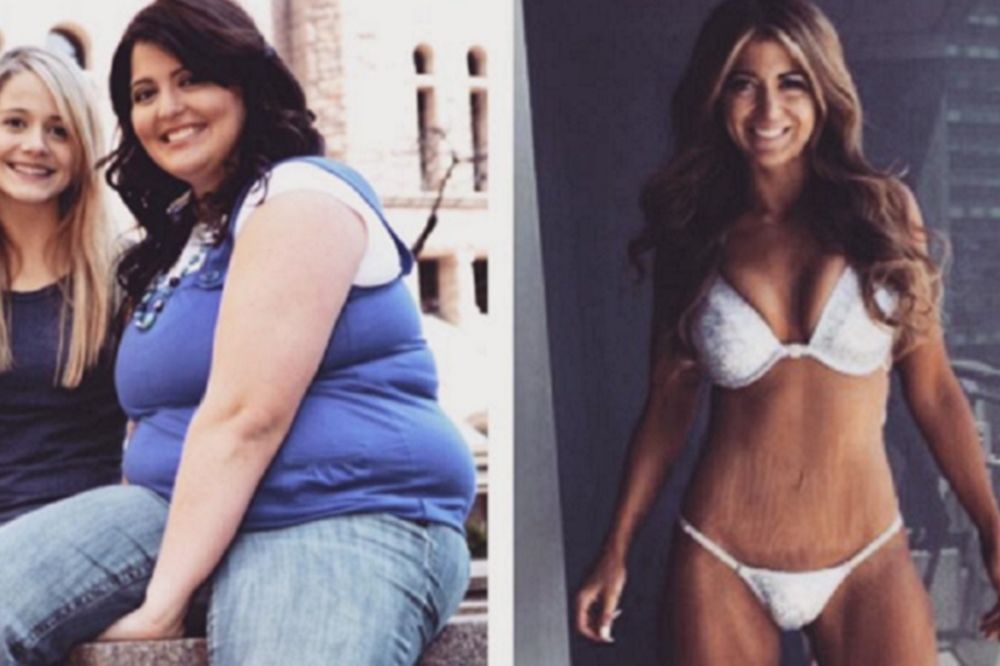 Ova bucka pretvorila se u pravu ribetinu: Evo kako sam smršala 70 kila! (FOTO)