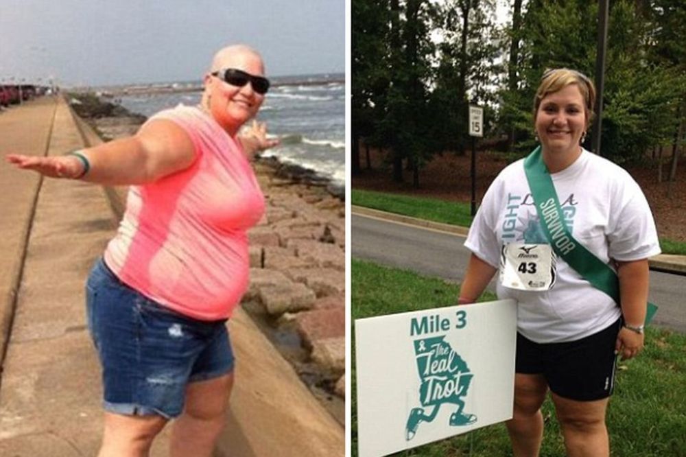 Medicinska sestra dobila 25.000 dolara pretvarajući se da ima rak (FOTO)