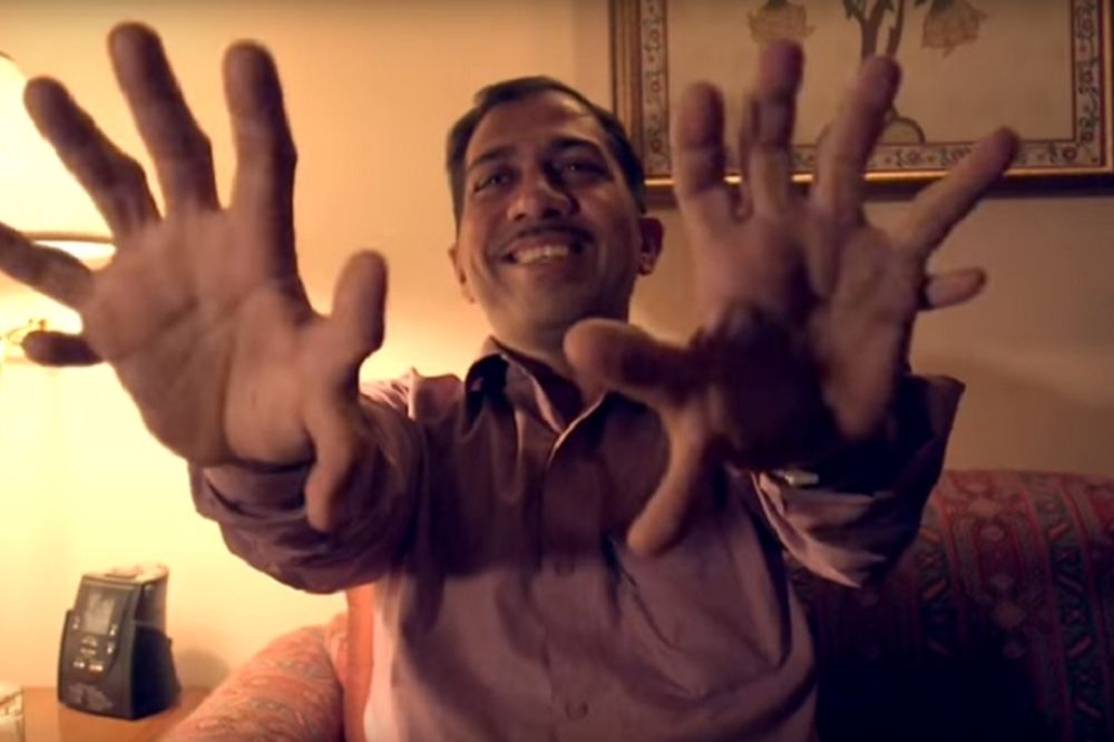 Čovek s 28 prstiju: Osećam se kao svetska zvezda! (VIDEO)