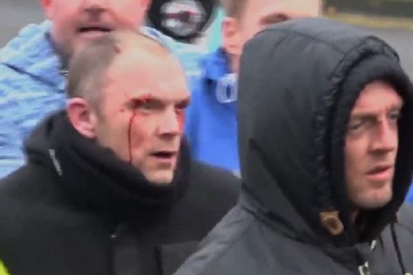 Makljaža fašista i antifašista u Engleskoj! Nije za one sa slabim želucem (VIDEO)