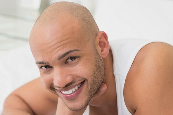 Recite zbogom ćelavosti! Za ovaj lek kažu da je delotvoran! (GIF)