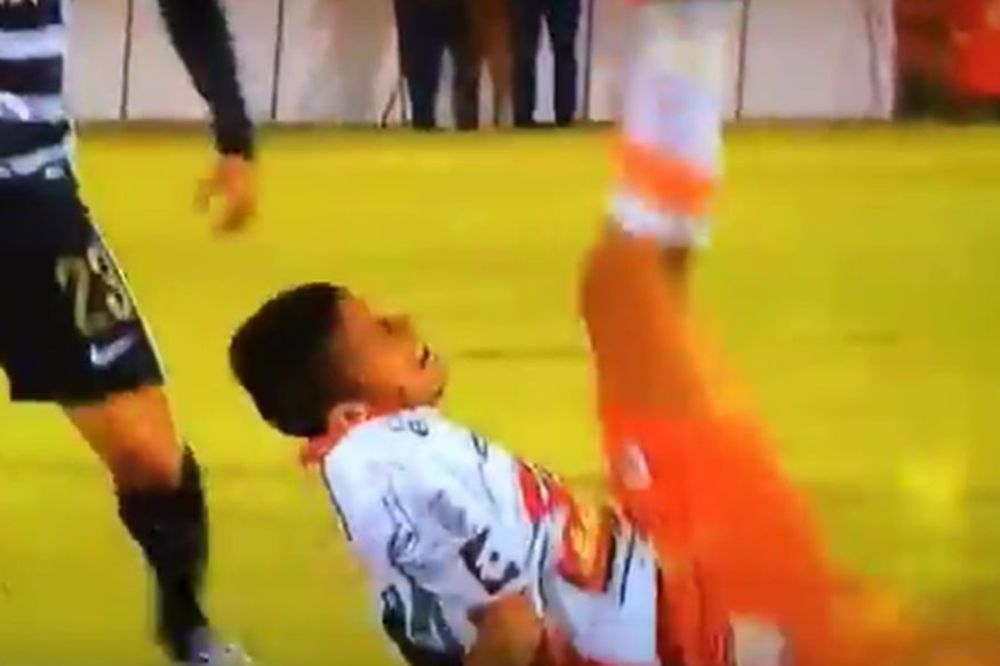Užasna povreda argentinskog fudbalera: Posle duela polomio ruku! (UZNEMIRUJUĆI VIDEO)