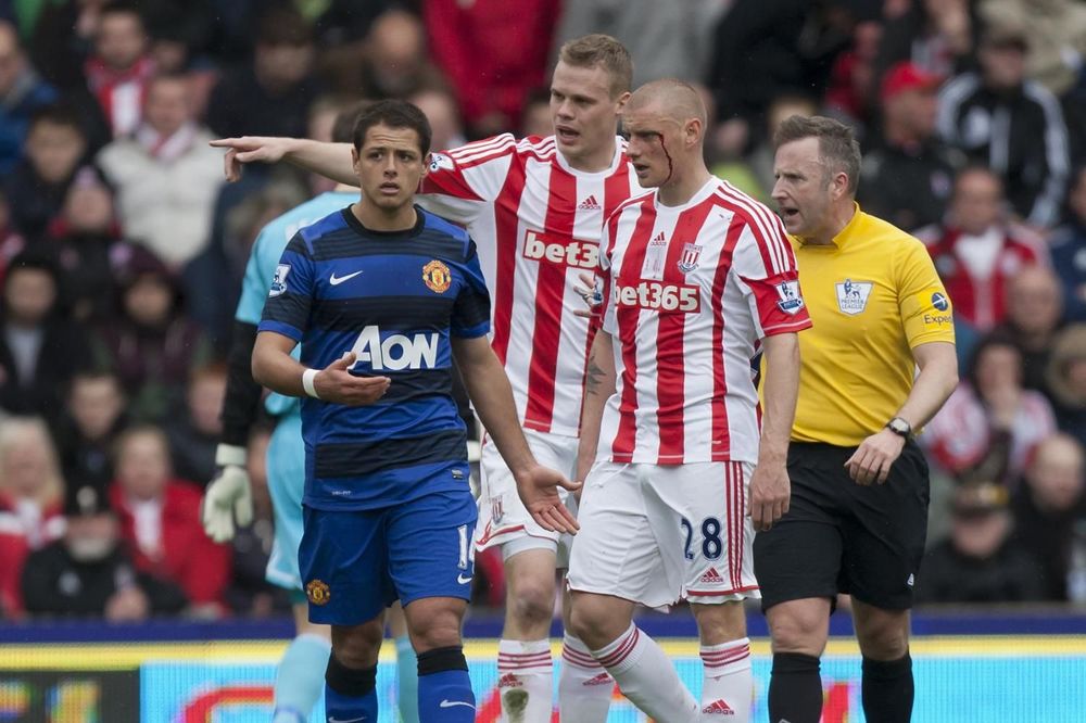 Udarac loptom u glavu okončao karijeru premijerligaškom fudbaleru! (VIDEO)