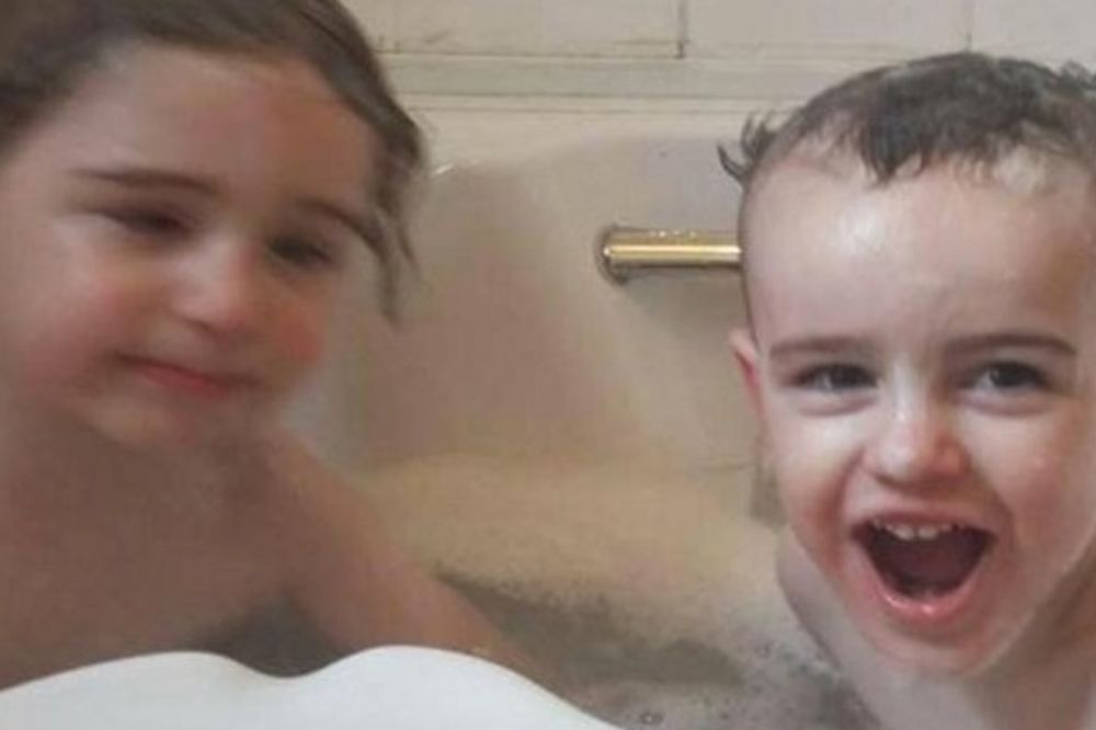 Kako da vam ne pocepa srce? Ova dva šećera nastradala su u požaru! (FOTO) (VIDEO)