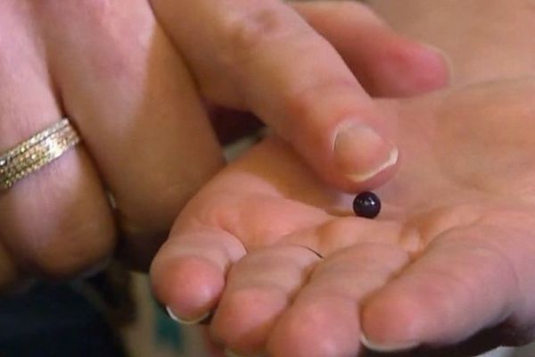 Usta kao školjka: Ova žena je umalo progutala skupoceni biser! (FOTO) (VIDEO)