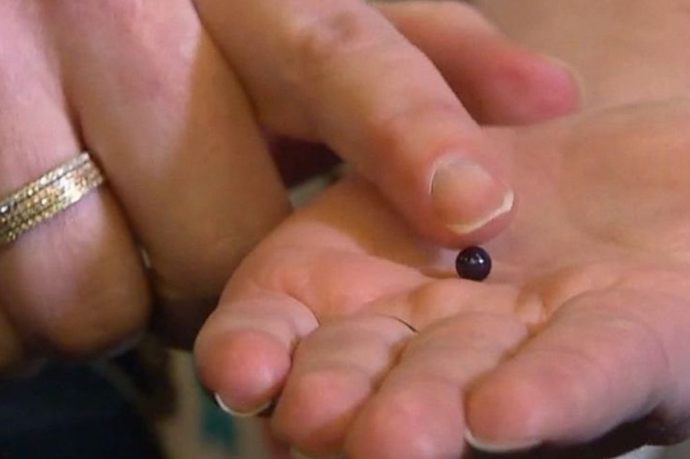 Usta kao školjka: Ova žena je umalo progutala skupoceni biser! (FOTO) (VIDEO)