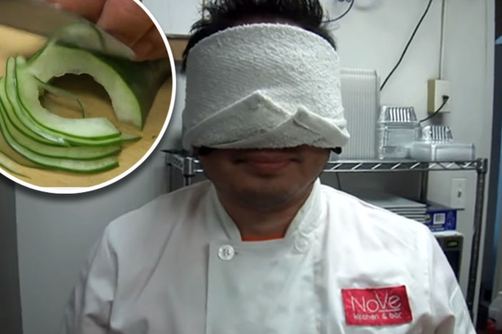 Kuvar zvani Supersecko! Kakav doktor! (VIDEO)