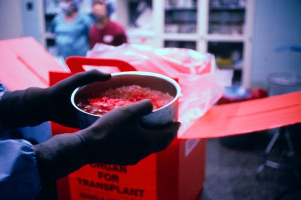 Nemate love? Prodajte bubreg u Iranu!