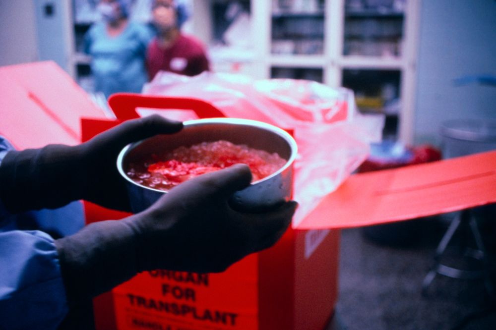 Nemate love? Prodajte bubreg u Iranu!