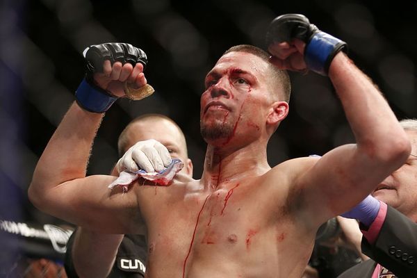 Koliko god da si jak, uvek ima neko jači: Konor MekGregor brutalno isprebijan u ringu! (FOTO) (VIDEO)